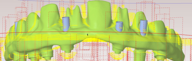 CAD/CAM